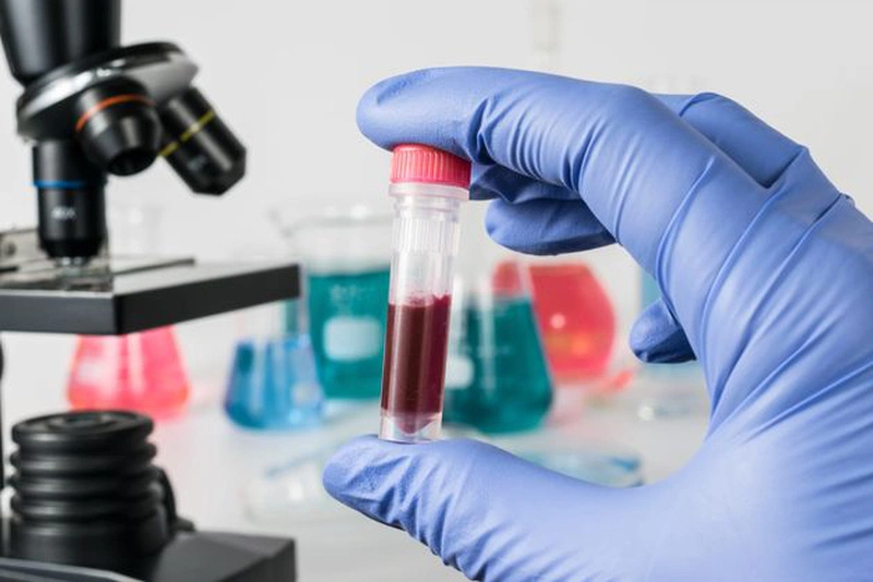 Xét nghiệm suy thận bao gồm nhiều xét nghiệm nhỏ liên quan khác nhau