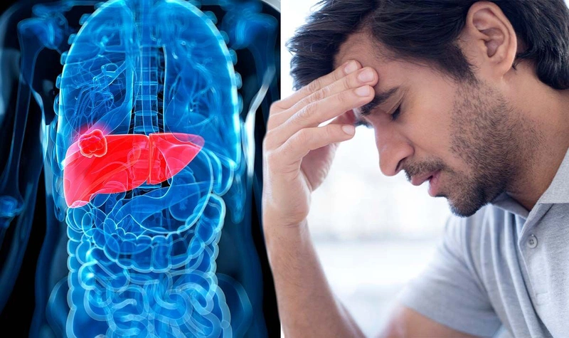 Xơ gan mất bù là bệnh gì? Các biến chứng nguy hiểm với sức khỏe