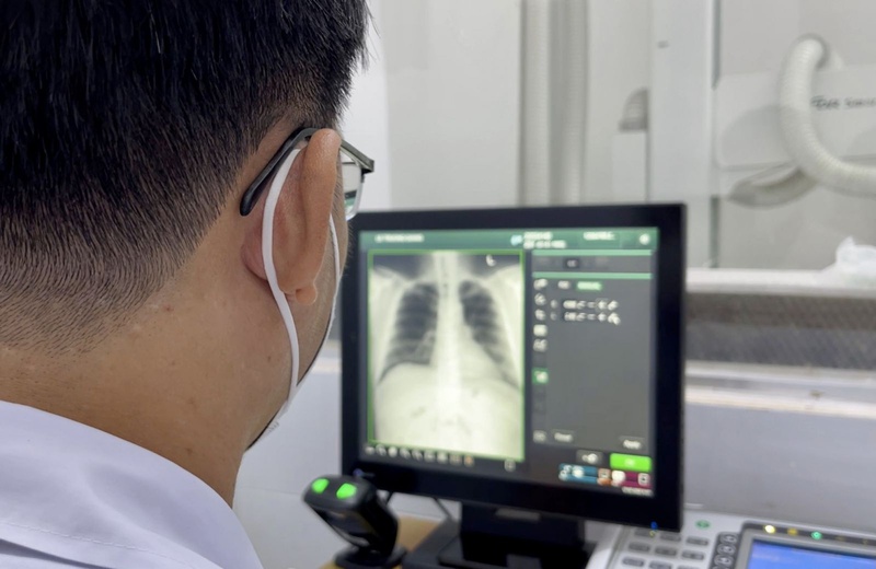 Những ai có nguy cơ xơ phổi hậu covid? - Nhà thuốc FPT Long Châu