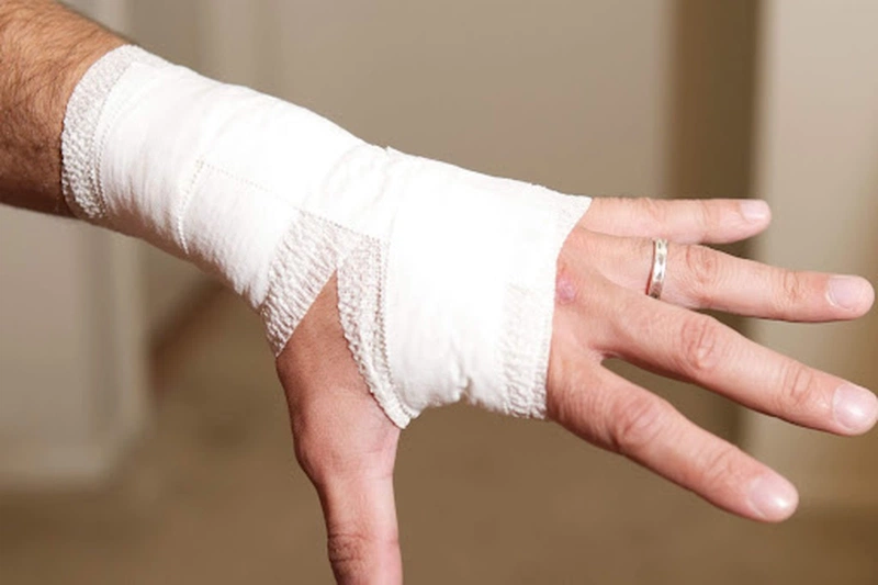 Bạn đã biết cách sơ cứu và xử lý bong gân cổ tay đúng cách?2