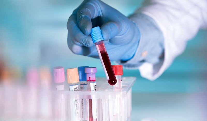 Ý nghĩa của những xét nghiệm viêm gan B phổ biến 2