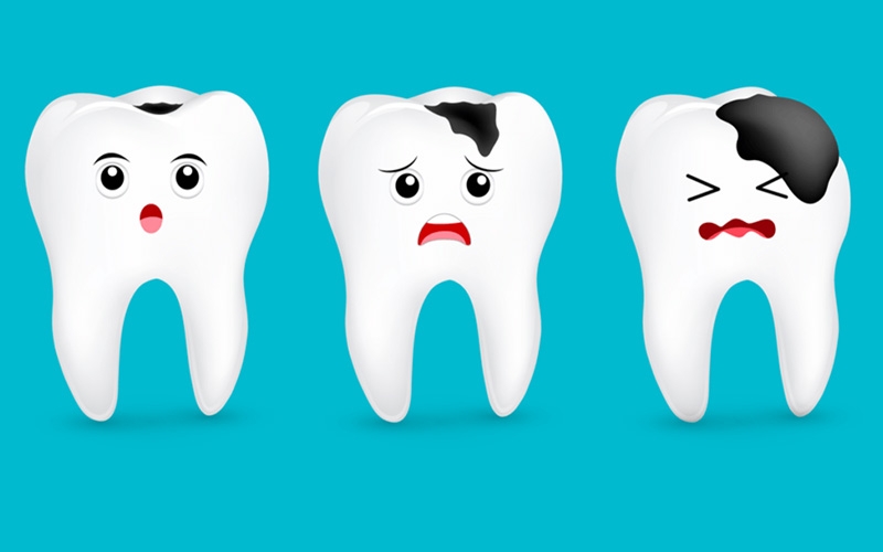 Fluor là gì? Tác dụng của fluor đối với sức khỏe răng miệng 2