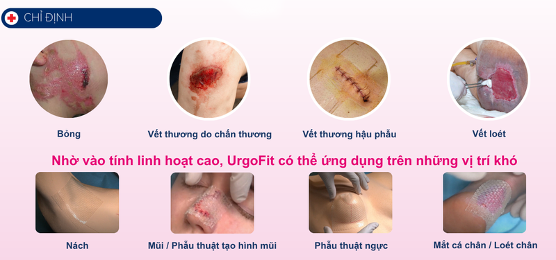 gac-luoi-linh-hoat-om-sat-urgofit-10-cm-x-10-cm-10-mieng (2).png