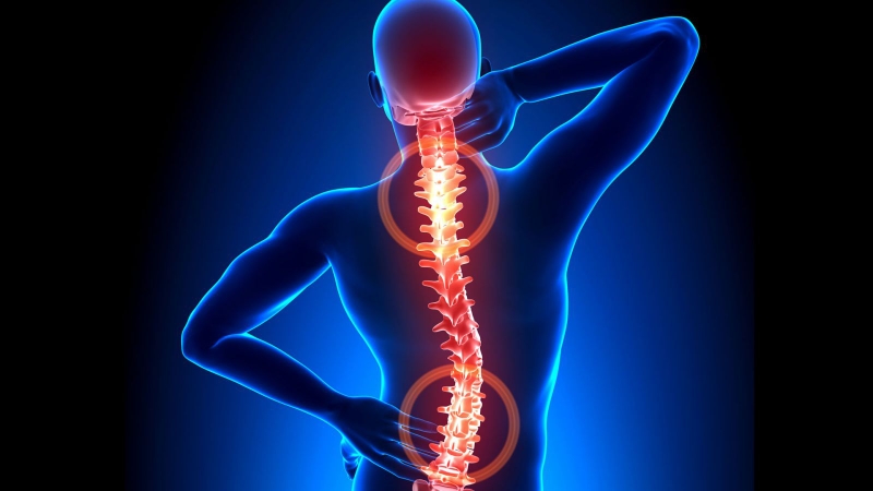 Dấu hiệu nhận biết và điều trị bệnh gai cột sống thoát vị đĩa đệm 1