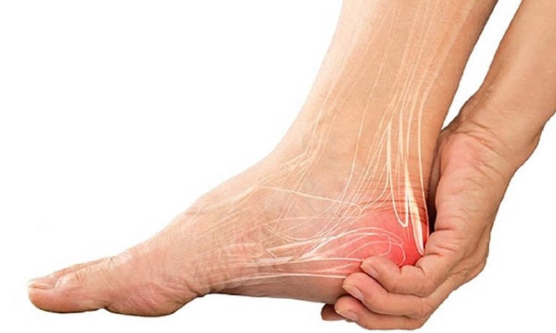 Gai gót chân có nên đi bộ không? Cách điều trị hiệu quả 1