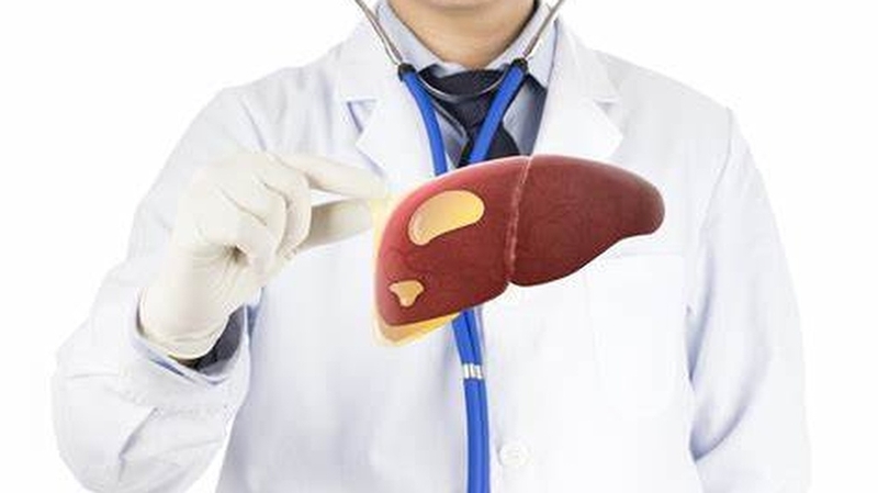 Gan nhiễm mỡ độ 1 có chữa khỏi không? Khám phá cách quản lý bệnh hiệu quả 3