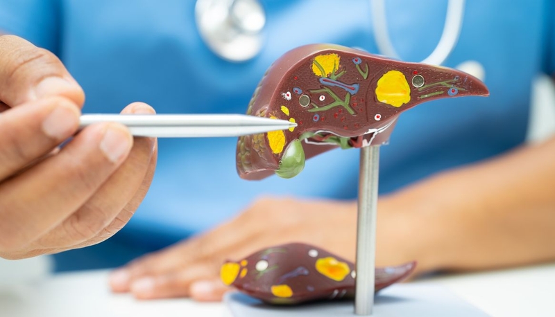 Gan nhiễm mỡ ở người già: Nguyên nhân, triệu chứng, cách điều trị 1