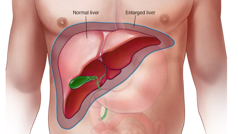 gan-to-co-chua-duoc-khong 1