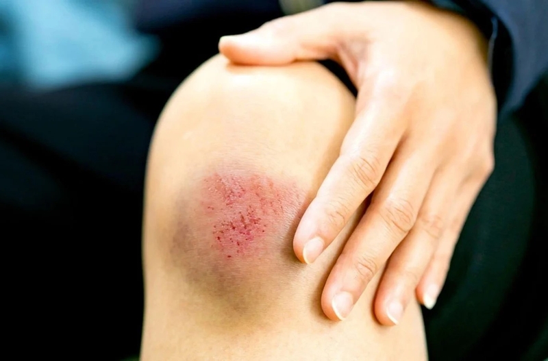 Gạo nếp có tác dụng gì đối với sức khỏe? - 5