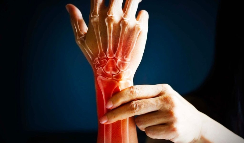 Gập ngón tay bị đau là do đâu và cách điều trị, phòng ngừa 2