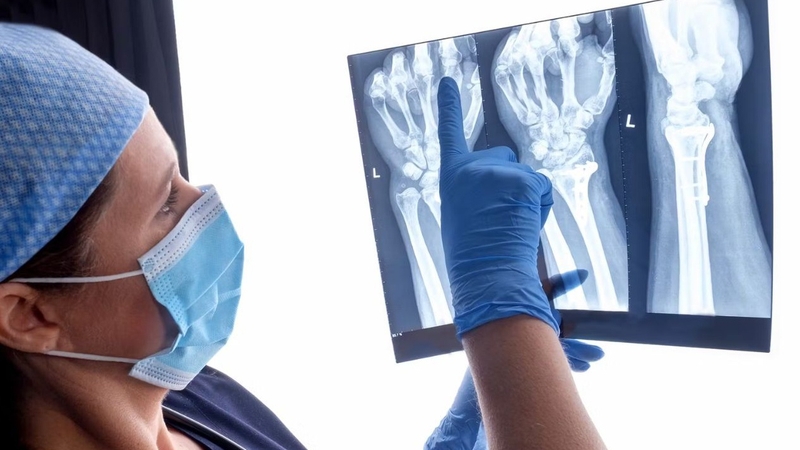 Gãy đầu xa xương cánh tay có triệu chứng gì? Làm thế nào để khắc phục? 2