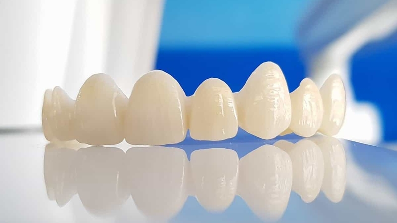 Gãy răng gây ra những ảnh hưởng nào với sức khỏe 4