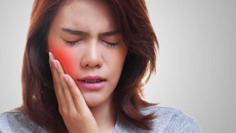 Gây tê hay gây mê khi nhổ răng khôn và những lưu ý sau khi nhổ răng 3