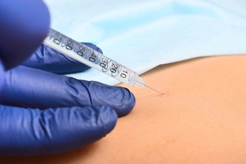 Gây tê khoang cùng là gì? Biến chứng có thể xuất hiện - 1