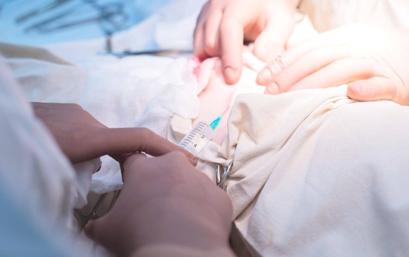 Gây tê khoang cùng là gì? Biến chứng có thể xuất hiện - 3