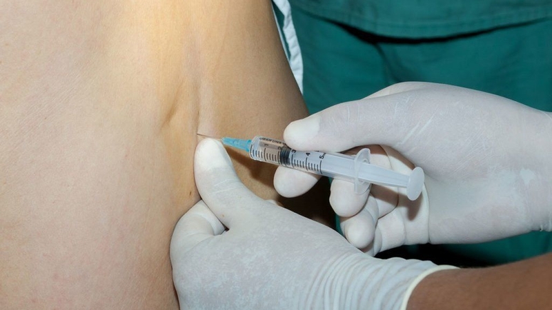 Gây tê ngoài màng cứng và gây tê tủy sống có phải là một 2