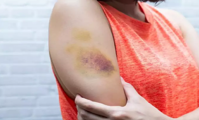 Gây tê vùng phong bế thần kinh ngoại vi những thông tin cần biết 4