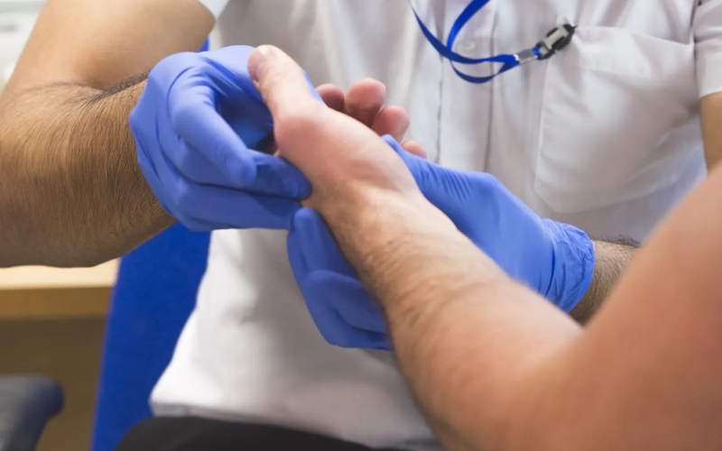 Gãy xương bàn tay bao lâu thì lành? Tìm hiểu ngay! 5