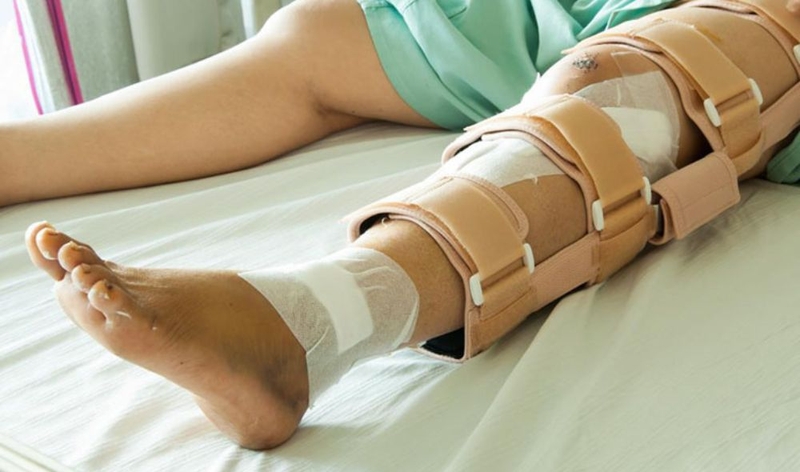Gãy xương bánh chè có nguy hiểm không và cách khắc phục 4