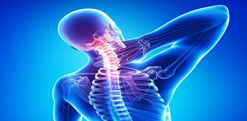 Tổng quan về tình trạng gãy xương cổ 3