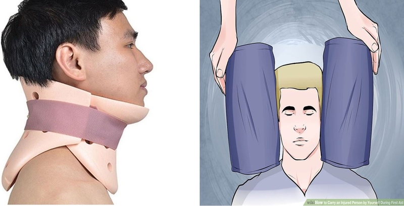 Tổng quan về tình trạng gãy xương cổ 5