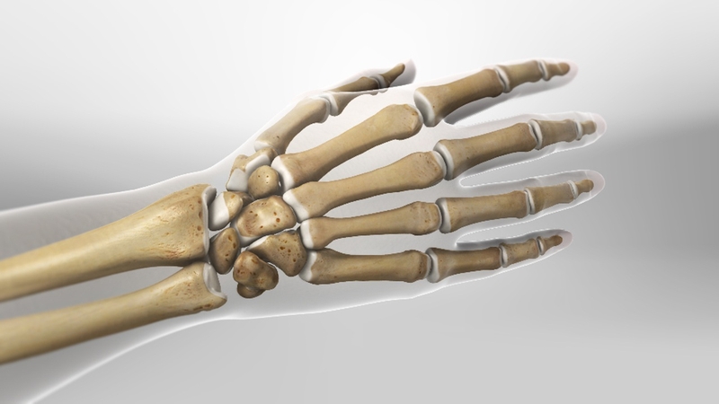 Gãy xương cổ tay bao lâu thì lành Chữa trị gãy xương cổ tay 1