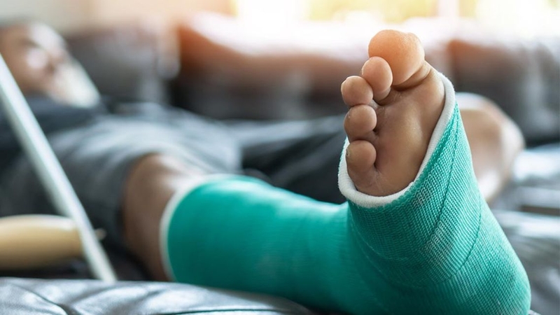 Gãy xương mác có đá bóng được không? Lời khuyên từ chuyên gia 2