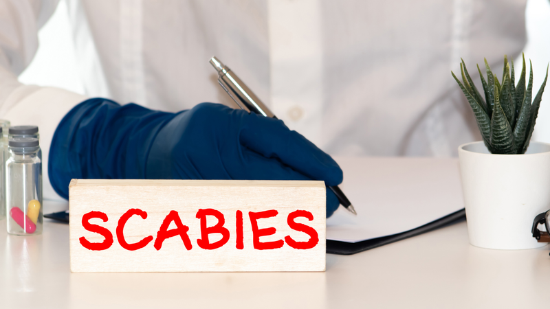 Ghẻ nước bôi gì?4