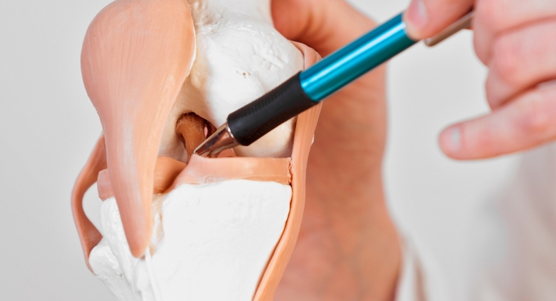 Ghép sụn khớp là gì? Các phương pháp ghép sụn phổ biến 3