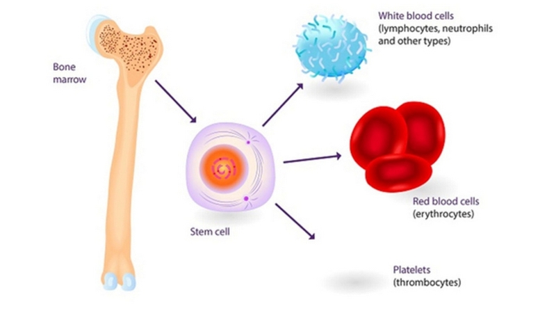 Ghép tế bào gốc chữa ung thư máu - Cơ hội cho người bệnh ung thư máu 2