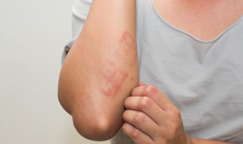 Ghép tế bào gốc tạo máu và những điều nên biết 2