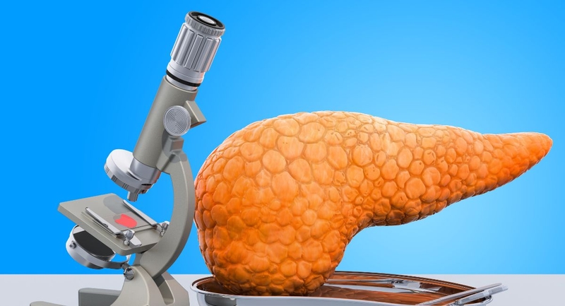 Ghép tụy là gì? Những đối tượng nào cần ghép tụy 1