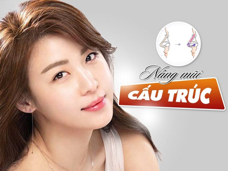 Nâng mũi cấu trúc là gì?