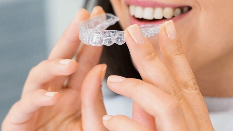 Niềng răng trong suốt có tính thẩm mỹ cao, gần như không dễ nhận thấy khi đeo nên khó nhận ra