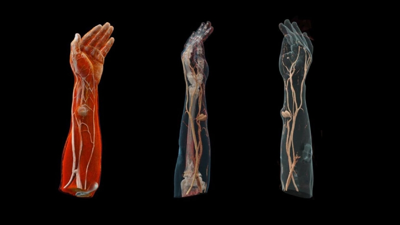 Giả phình mạch và những điều cần biết 4