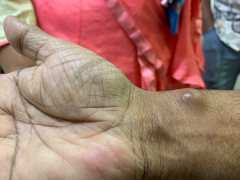 Giả phình mạch và những điều cần biết 5