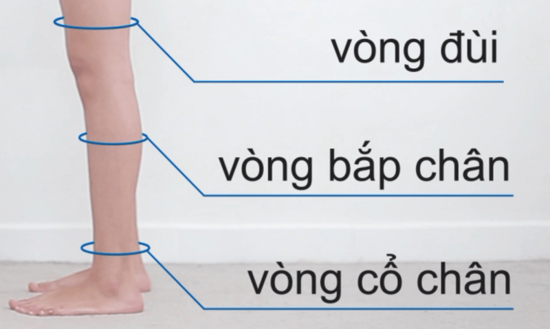 Giá vớ y khoa là bao nhiêu và nơi nào bán uy tín? 3