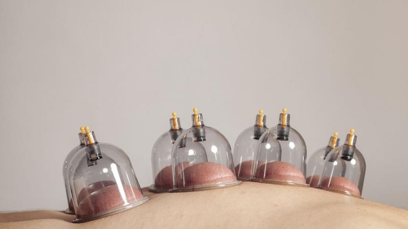 Người bệnh có thể ngồi hoặc nằm tùy theo vùng điều trị