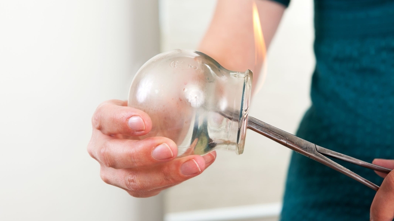 Người thực hiện có thể bị phỏng nhiệt (trong giác hơi lửa)