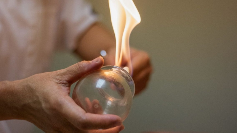 Giác hơi có tốt không mà đã được sử dụng rộng rãi trong y học cổ truyền từ xa xưa?