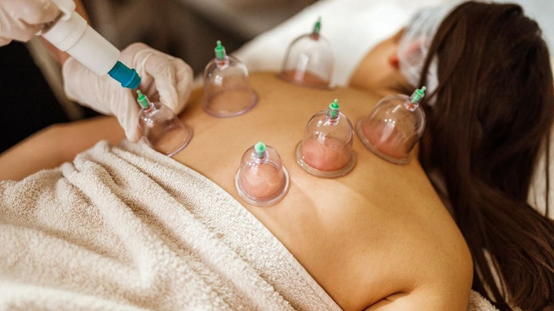 Cần thực hiện giác hơi đúng chỉ định, đúng kỹ thuật