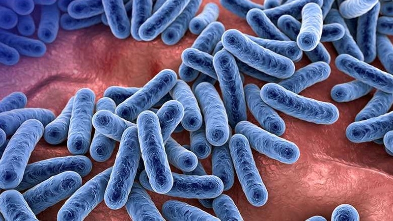 Giải đáp: Áp xe hậu môn là gì? Cách trị áp xe hậu môn tại nhà có nên không? 1