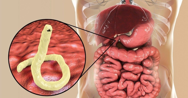 Bà bầu có ăn được tiết canh vịt không? Câu trả lời là không để tránh bị nhiễm giun xoắn