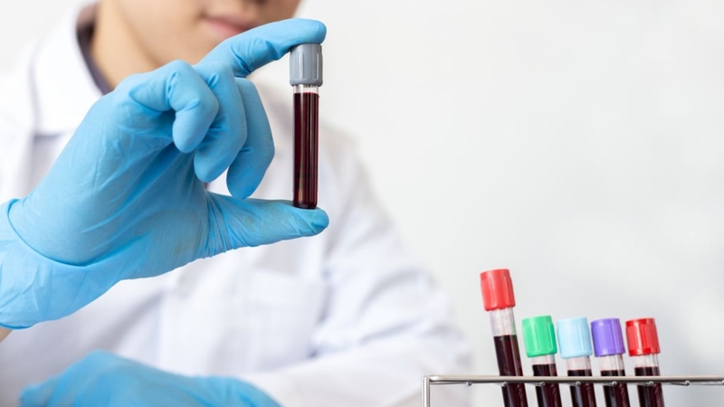 Giải đáp băn khoăn: Tầm soát ung thư cổ tử cung bao lâu có kết quả? 2