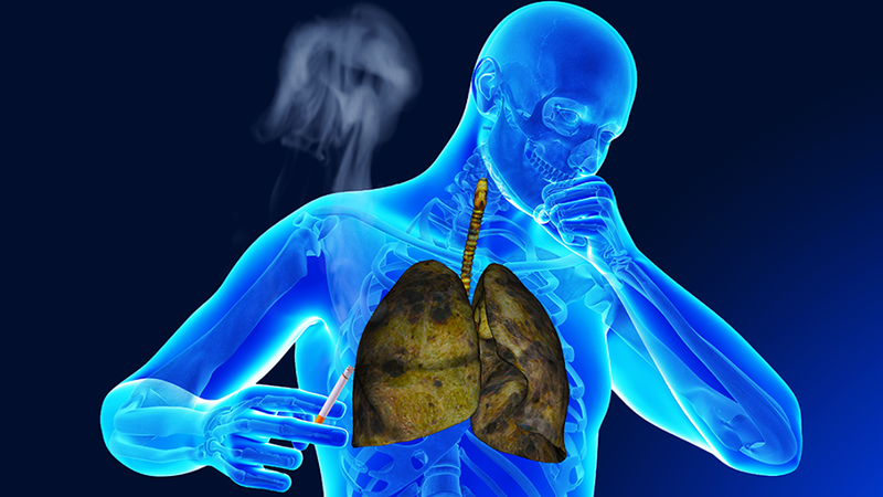 Giải đáp: Bệnh lao là gì? Bệnh lao có tự khỏi không? 2