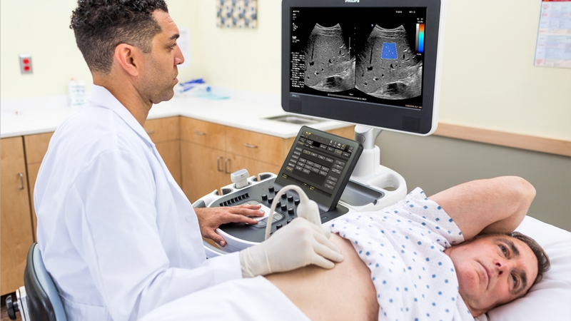 Giải đáp: Bệnh xơ gan có lây không Cách phòng chống là gì 5