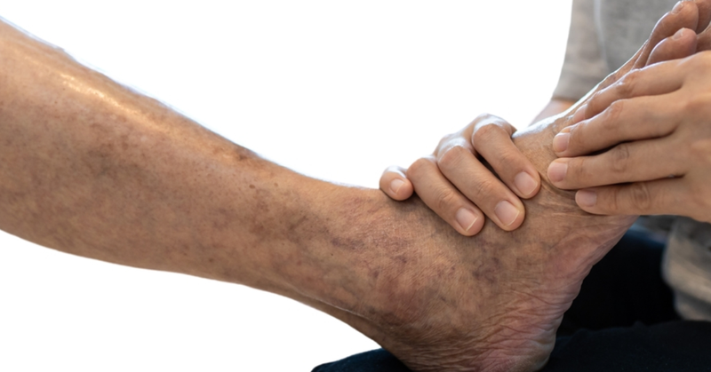 Giải đáp: bệnh xơ vữa động mạch gây hậu quả gì? 4