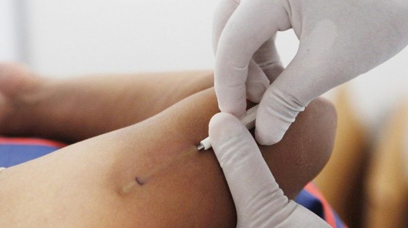 Giải đáp: Bị u xơ tử cung có đặt vòng được không? 4