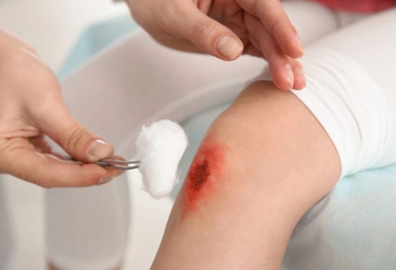 Giải đáp: Bị vết thương hở có được ăn chuối không? 1