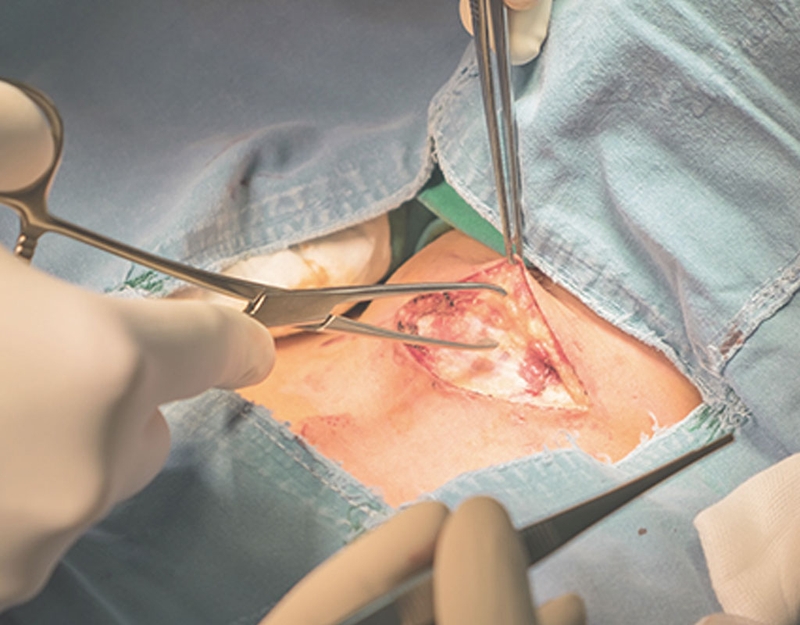 [GIẢI ĐÁP] Bướu cổ là gì? Bệnh bướu cổ nguy hiểm không?3